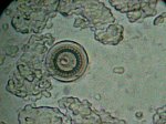 Trichodina Ciliated Protozoan Parasite, Symptoms Identification and Treatment