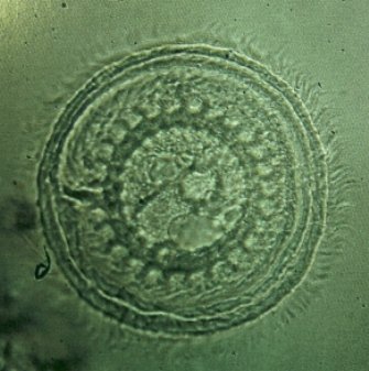 Trichodina Ciliated Protozoan Parasite, Symptoms Identification and Treatment