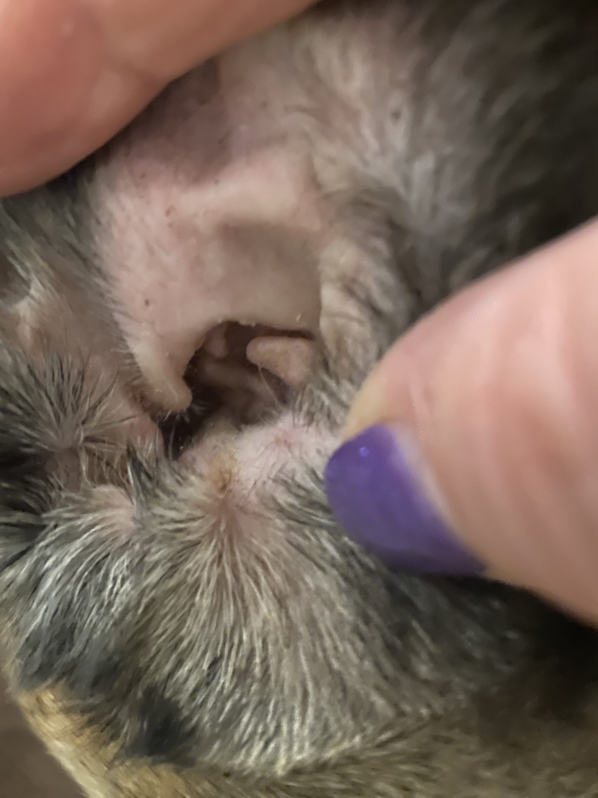 This is the "normal" ear in the patient. Note that there isn't a ton of hair in the ear. So that isn't a predisposing factor. 